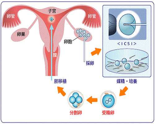 要不要去香港冻卵？ 合肥有代生吗